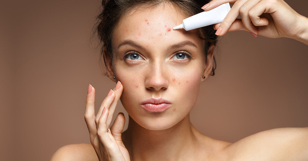Isotretinoin - Know What is Accutane, and it's Side Effects Setu Nutrition Isotretinoin - Know What is Accutane, and it's Side Effects Setu Nutrition