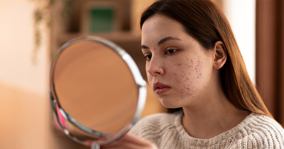 Pigmentation Control Regimen: Collagen & Glutathione Supplements Setu Nutrition Pigmentation Control Regimen: Collagen & Glutathione Supplements Setu Nutrition