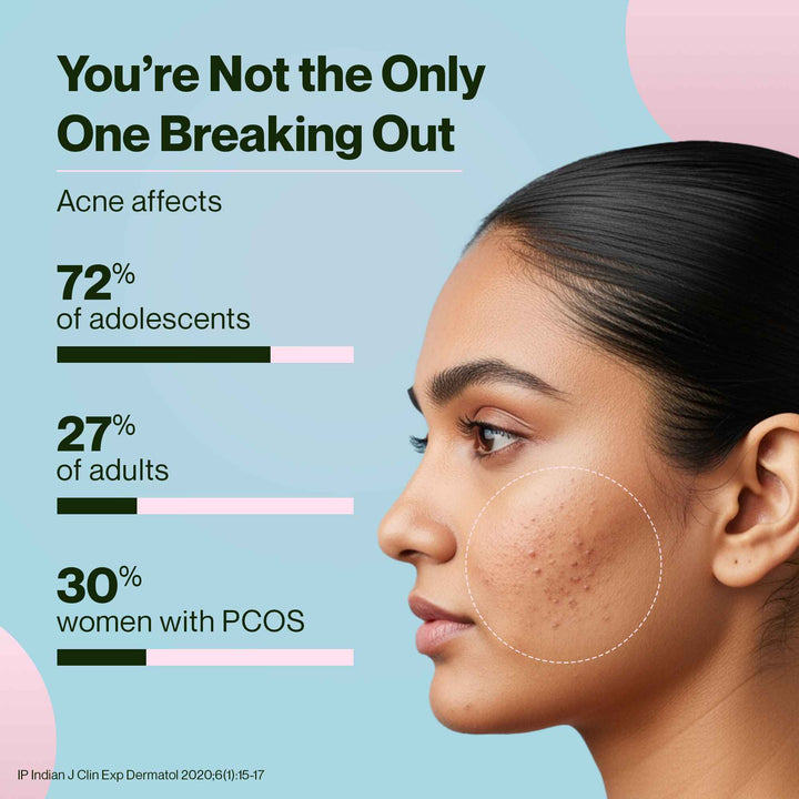 Skin: AcneClear - Powder