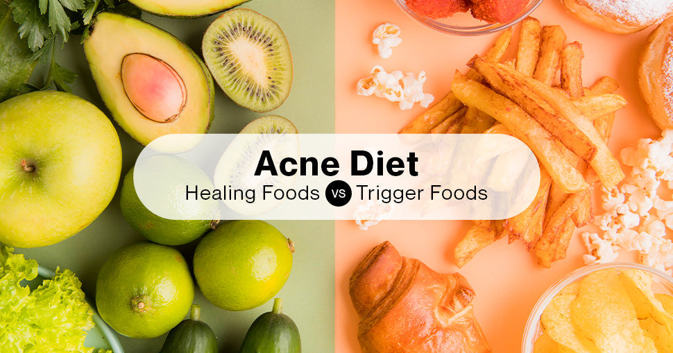 Foods That Calm Stubborn Acne by Healing the Gut