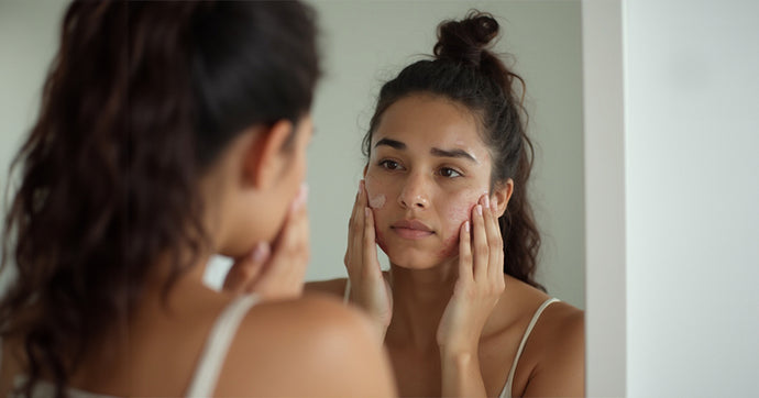 An Acne-Friendly Skincare Routine