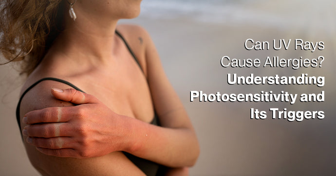 Can UV Rays Cause Allergies? Understanding Photosensitivity and Its Triggers