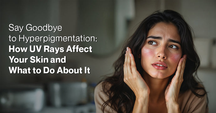 Say Goodbye to Hyperpigmentation: How UV Rays Affect Your Skin and What to Do About It