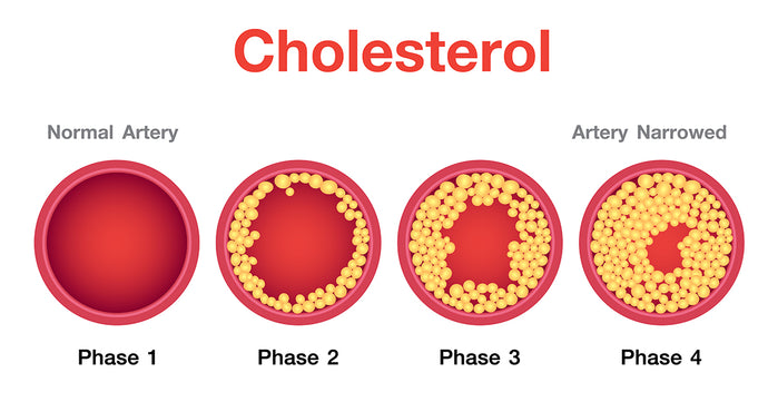 High Cholesterol In Your 20s and 30s? Causes & Prevention