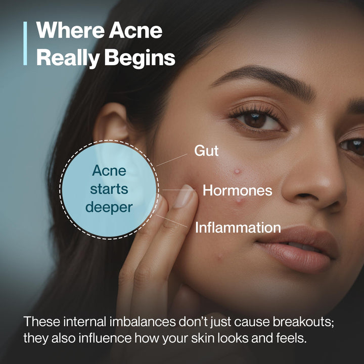 Clear Skin Combo – Anti-Acne, Spot Reduction & Skin Glow Kit - Setu Nutrition