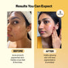 Radiant Skin Glow Combo – Glutathione & Marine Collagen for Bright, Younger-Looking Skin