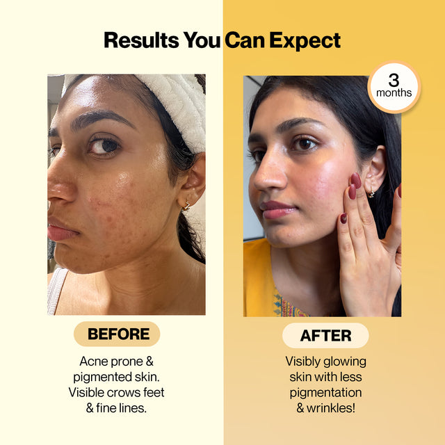 Radiant Skin Combo: Glutathione & Marine Collagen