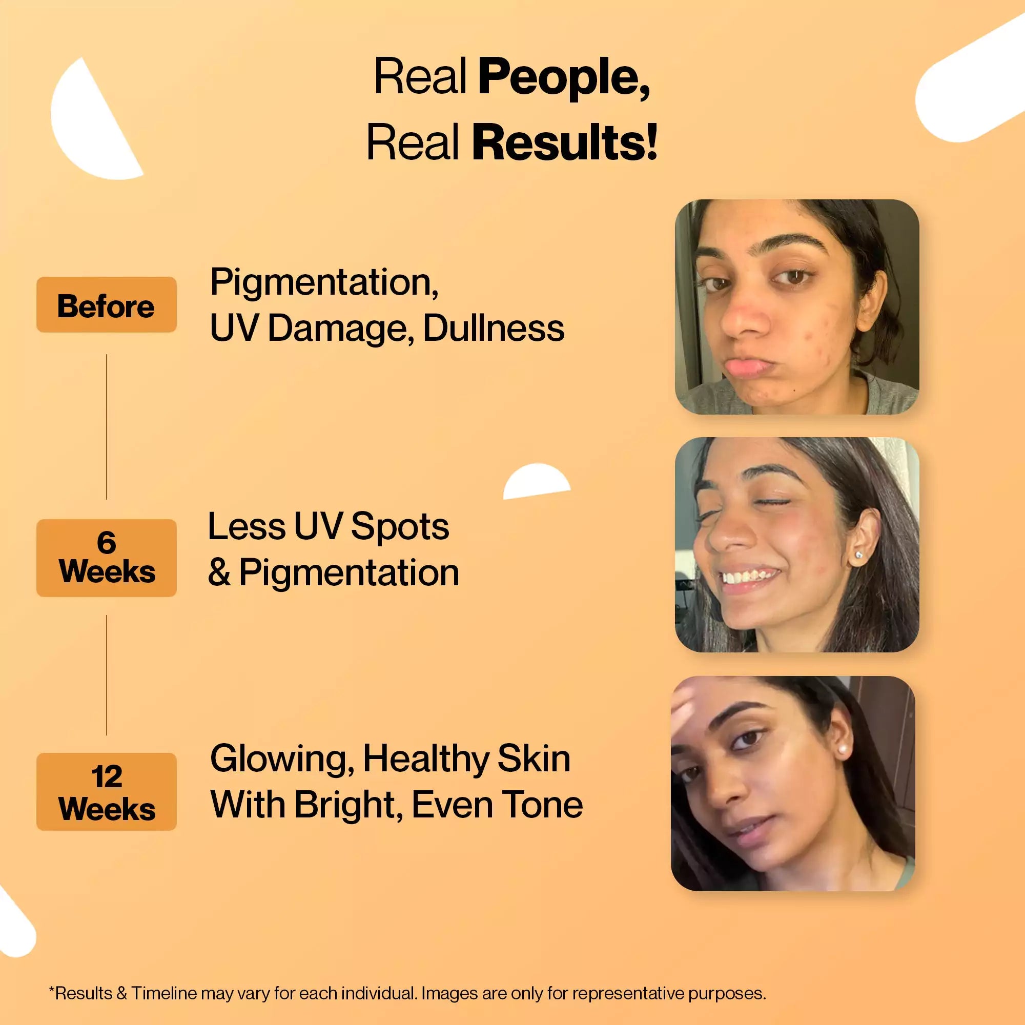 glutathione results in how many days Setu Skin Renew Tablets with Glutathione & Vitamin C